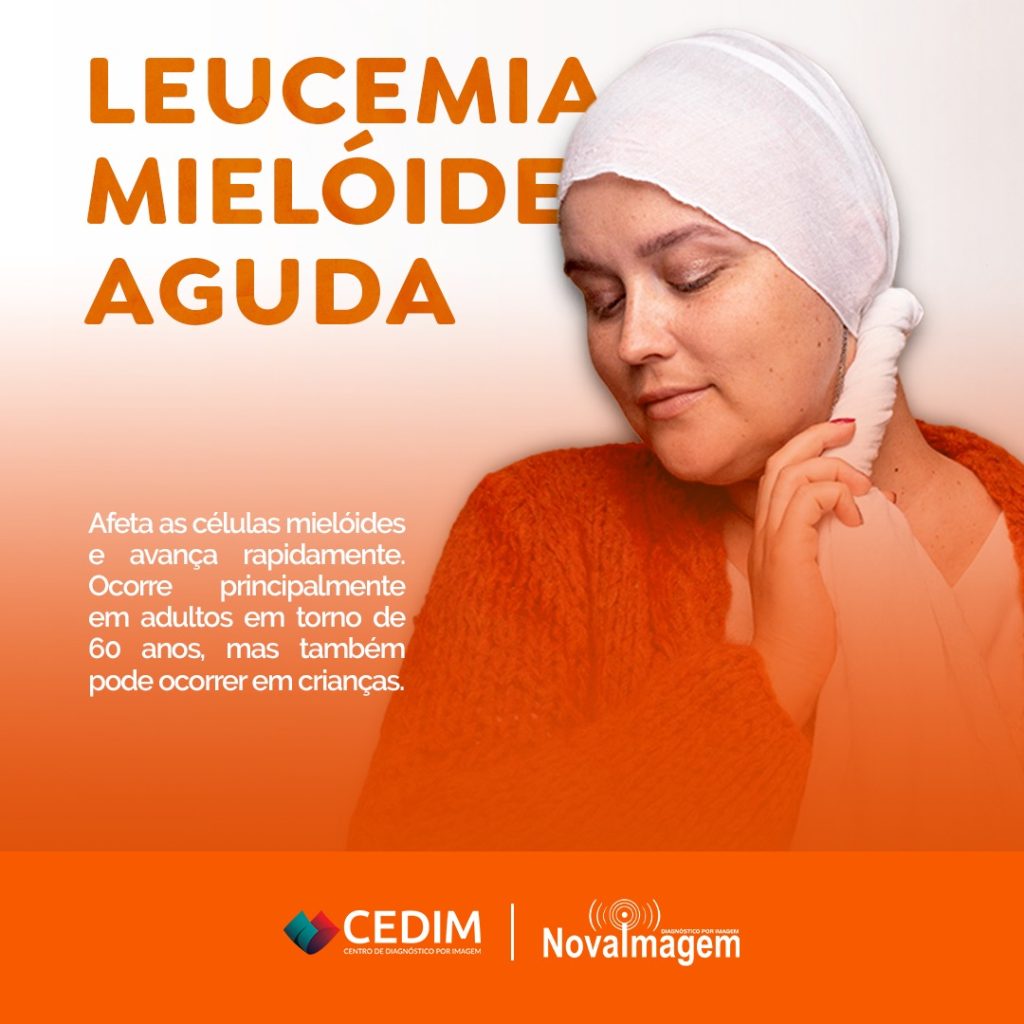 Leucemia Mielóide Aguda Nova Imagem Cacoal Centro De Diagnóstico Por Imagem 3240
